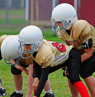 mouthguards